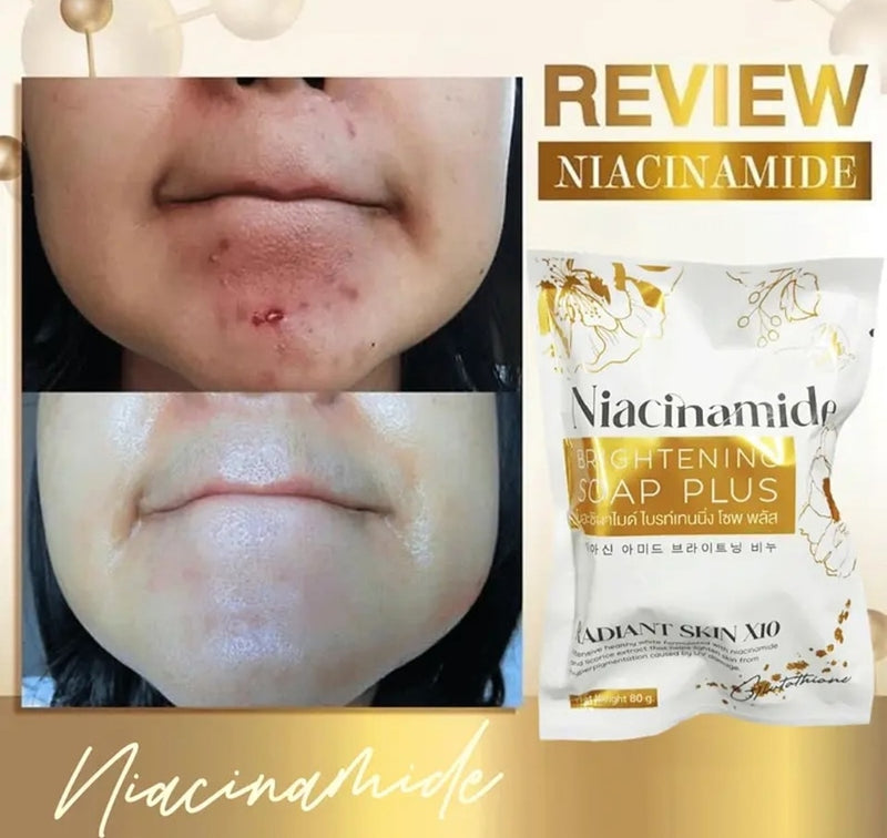Authentic From Thailand! Glow Skin Niacinamide Brightening Soap