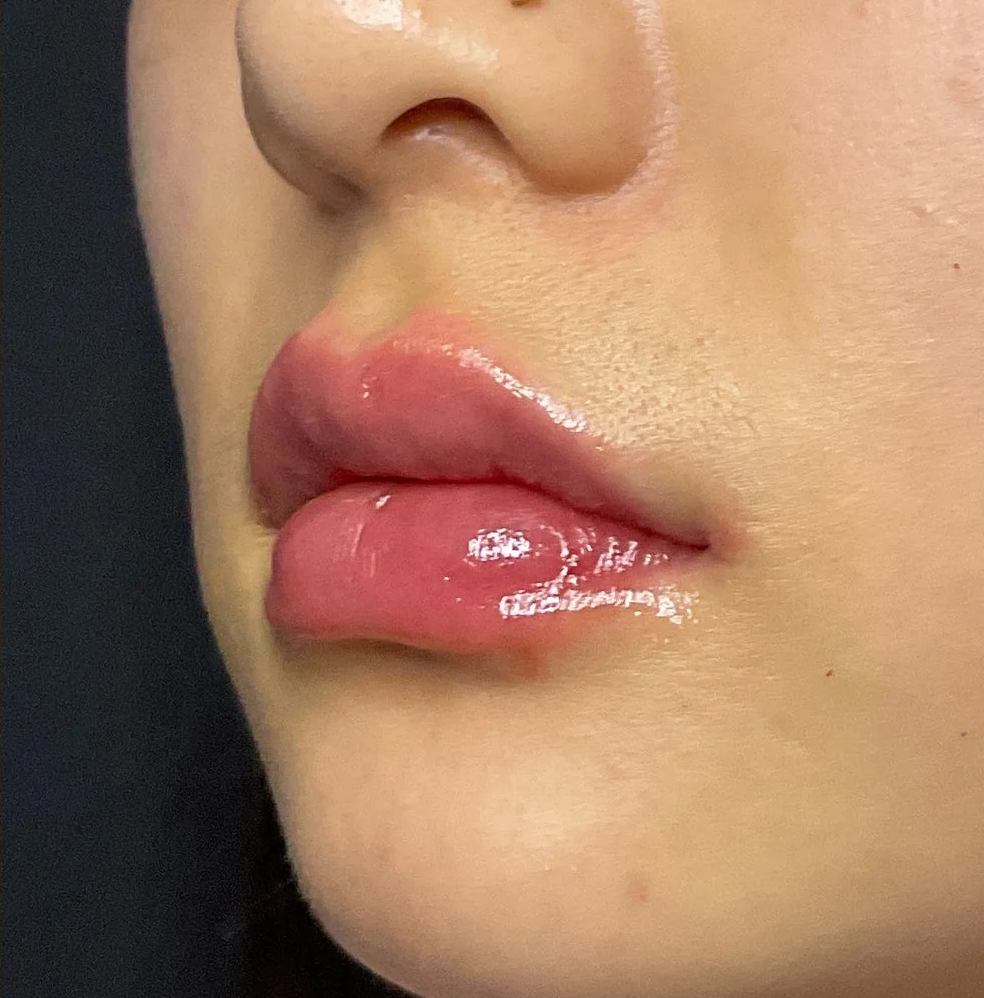 BossBabe Vitamin Rose Lip Serum 10ml